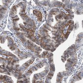 Anti-BCAM antibody produced in rabbit Prestige Antibodies® Powered by Atlas Antibodies, affinity isolated antibody, buffered aqueous glycerol solution