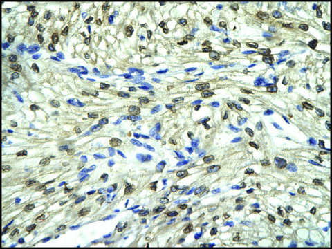 Anti-FLI1 antibody produced in rabbit affinity isolated antibody