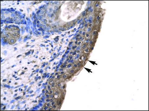 Anti-RNF12 antibody produced in rabbit affinity isolated antibody