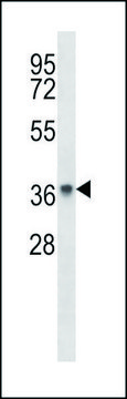 ANTI-PAQR8 (C-TERM) antibody produced in rabbit IgG fraction of antiserum, buffered aqueous solution