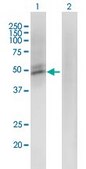 Monoclonal Anti-ACMSD antibody produced in mouse clone 3A9, purified immunoglobulin, buffered aqueous solution