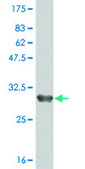Monoclonal Anti-ZDHHC8 antibody produced in mouse clone 1C5, purified immunoglobulin, buffered aqueous solution