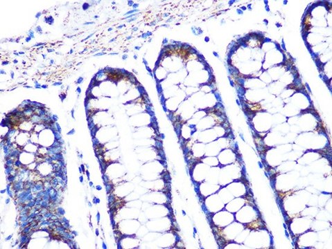 Anti-PBR/TSPO antibody produced in rabbit