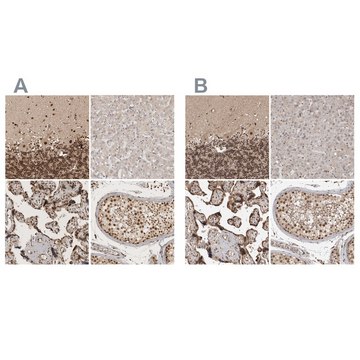 Anti-CBLL1 antibody produced in rabbit Prestige Antibodies&#174; Powered by Atlas Antibodies, affinity isolated antibody, buffered aqueous glycerol solution, Ab1