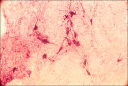 Anti-Vesicular Acetylcholine Transporter (VAChT) antibody produced in rabbit affinity isolated antibody, buffered aqueous solution