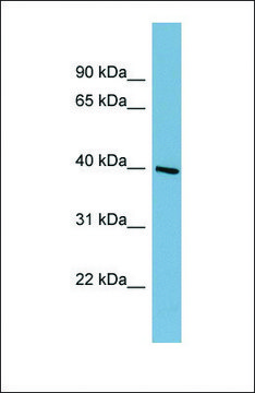 Anti-ST8SIA6 antibody produced in rabbit affinity isolated antibody