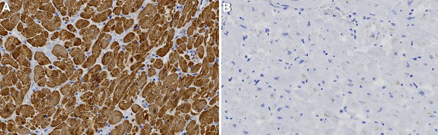 Anti-MLC-2 Antibody, clone 1B16 ZooMAb&#174; Rabbit Monoclonal recombinant, expressed in HEK 293 cells