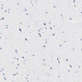 Anti-HLA-DOB antibody produced in rabbit Prestige Antibodies® Powered by Atlas Antibodies, affinity isolated antibody, buffered aqueous glycerol solution