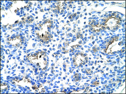 Anti-CEACAM6 IgG fraction of antiserum