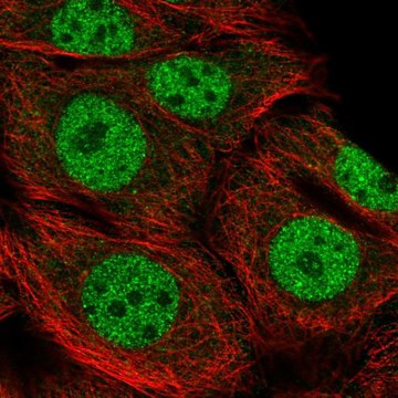 Anti-RBBP8 antibody produced in rabbit Prestige Antibodies&#174; Powered by Atlas Antibodies, affinity isolated antibody