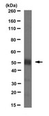 Anti-acetyl-alpha tubulin Antibody, clone 6-11B-1 clone 6-11B-1, from mouse