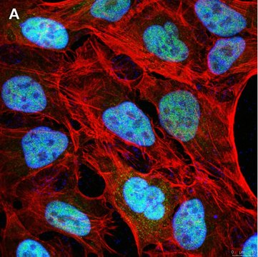 Anti-NCOA1 Antibody, clone 5B9, ZooMAb&#174; Rabbit Monoclonal recombinant, expressed in HEK 293 cells