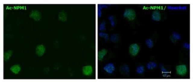 Anti-Acetylated Nucleophosmin Antibody, clone 31M1 clone 31M1, from mouse