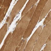 Anti-PDLIM3 antibody produced in rabbit Prestige Antibodies® Powered by Atlas Antibodies, affinity isolated antibody, buffered aqueous glycerol solution