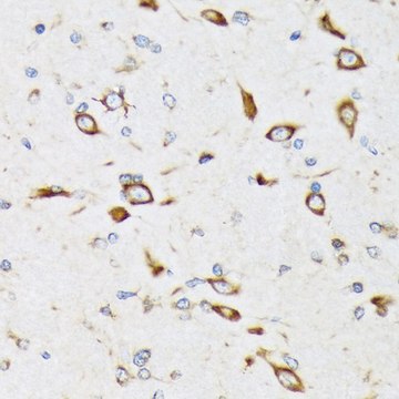 Anti-RPS20 antibody produced in rabbit