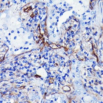 Anti-CD105 antibody produced in rabbit