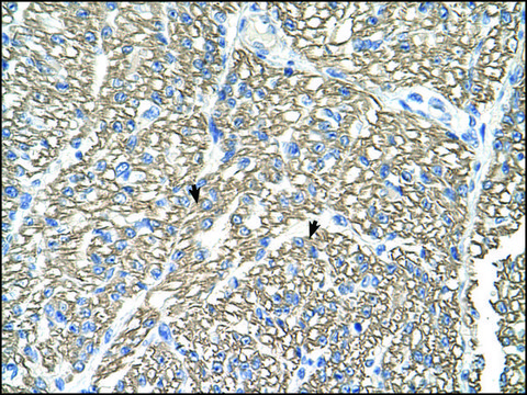 Anti-ATP1B1 antibody produced in rabbit affinity isolated antibody