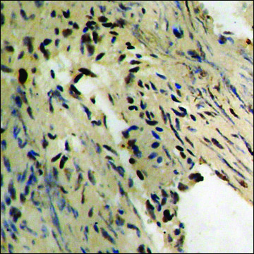 Anti-phospho-Tau (pThr231) antibody produced in rabbit affinity isolated antibody