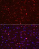 Anti-STAT3 antibody produced in rabbit