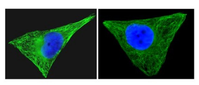 Anti-&#946;-Tubulin Antibody, clone AA2, Alexa Fluor&#8482; 488 conjugate clone AA2, Upstate&#174;, from mouse