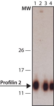 Anti-Profilin 2 (C-terminal) 兔抗 IgG fraction of antiserum, buffered aqueous solution