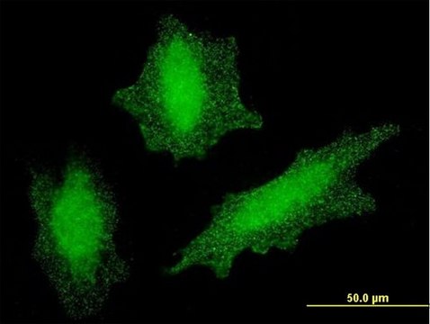 Monoclonal Anti-VHL antibody produced in mouse clone 1G12, purified immunoglobulin, buffered aqueous solution