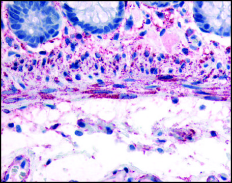 Anti-ADRA1B (AB2) antibody produced in rabbit affinity isolated antibody, buffered aqueous solution