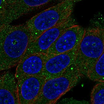 Anti-ZSWIM3 antibody produced in rabbit Prestige Antibodies&#174; Powered by Atlas Antibodies, affinity isolated antibody