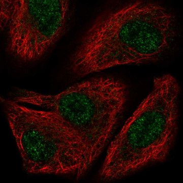 Anti-TOX2 antibody produced in rabbit Prestige Antibodies&#174; Powered by Atlas Antibodies, affinity isolated antibody