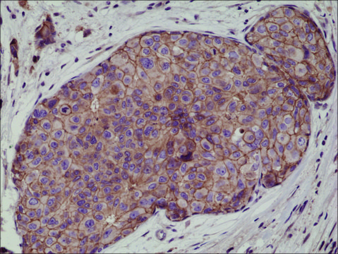 Anti-E-Cadherin (CDH1) antibody, Rabbit monoclonal recombinant, expressed in HEK 293 cells, clone RM244, purified immunoglobulin