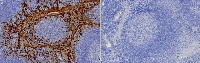 Anti-S100-A9/MRP14 Antibody, clone 1M6 ZooMAb&#174; Rabbit Monoclonal recombinant, expressed in HEK 293 cells