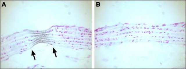 Anti-Calcium Channel (Cardiac &#945;1C Subunit) (L-type of Voltage-gated Ca2+ Channel) antibody produced in rabbit affinity isolated antibody, lyophilized powder