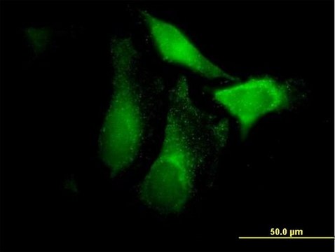 Anti-CFHR1 antibody produced in mouse IgG fraction of antiserum, buffered aqueous solution