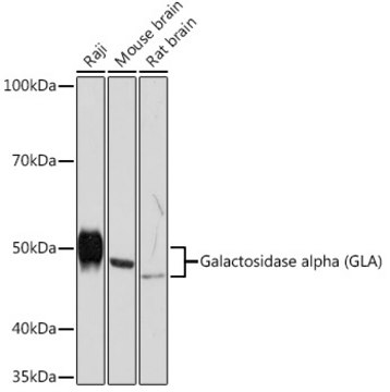 Anti-Galactosidase alpha (GLA) Antibody, clone 7G8T9, Rabbit Monoclonal