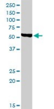 Anti-CHRDL1 antibody produced in rabbit purified immunoglobulin, buffered aqueous solution