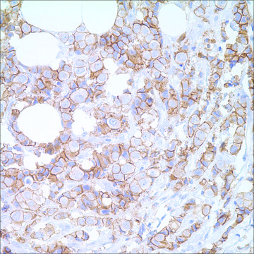 E-cadherin (EP700Y) Rabbit Monoclonal Primary Antibody