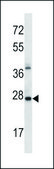 ANTI-ALKBH4 (CENTER) antibody produced in rabbit IgG fraction of antiserum, buffered aqueous solution