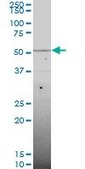 Monoclonal Anti-SMAD6 antibody produced in mouse clone 4F4, purified immunoglobulin, buffered aqueous solution