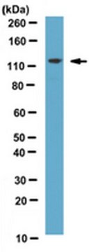 Anti-hRNF20 Antibody from rabbit, purified by affinity chromatography