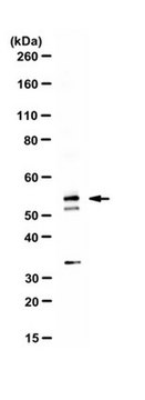 抗PP2A B亚基同种型B56-&#947;抗体 serum, from rabbit