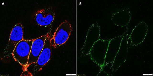 Anti-Integrin &#946;1 Antibody, clone P4C10 culture supernatant, clone P4C10, Chemicon&#174;