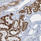 Anti-ACMSD antibody produced in rabbit Prestige Antibodies® Powered by Atlas Antibodies, affinity isolated antibody, buffered aqueous glycerol solution