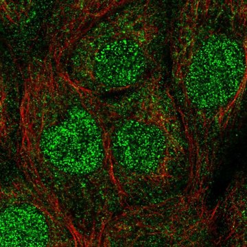 Anti-UBE2A antibody produced in rabbit Prestige Antibodies&#174; Powered by Atlas Antibodies, affinity isolated antibody