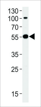 ANTI-PARKIN(N-TERMINAL) antibody produced in rabbit purified immunoglobulin, buffered aqueous solution