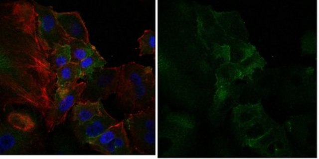 Anti-Surfactant Protein D Antibody, Alexa Fluor&#8482; 488 Conjugate from rabbit, ALEXA FLUOR&#8482; 488