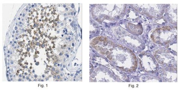 Anti-E3 ubiquitin-protein ligase UHRF2 Antibody from rabbit, purified by affinity chromatography