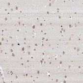 Anti-NUP153 antibody produced in rabbit Prestige Antibodies® Powered by Atlas Antibodies, affinity isolated antibody, buffered aqueous glycerol solution, ab3