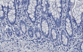 Anti-ATG12 Antibody, clone 1H18 ZooMAb® Rabbit Monoclonal recombinant, expressed in HEK 293 cells