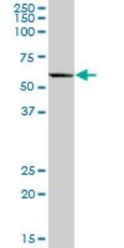 Anti-EPHX2 antibody produced in mouse IgG fraction of antiserum, buffered aqueous solution