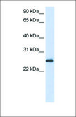 Anti-PRDX1 antibody produced in rabbit affinity isolated antibody